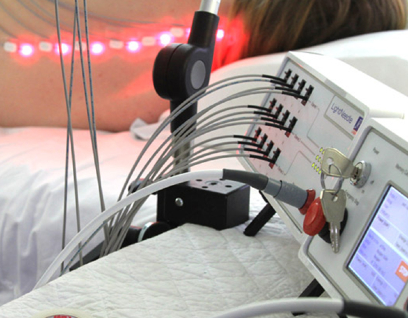 Agopuntura Laser